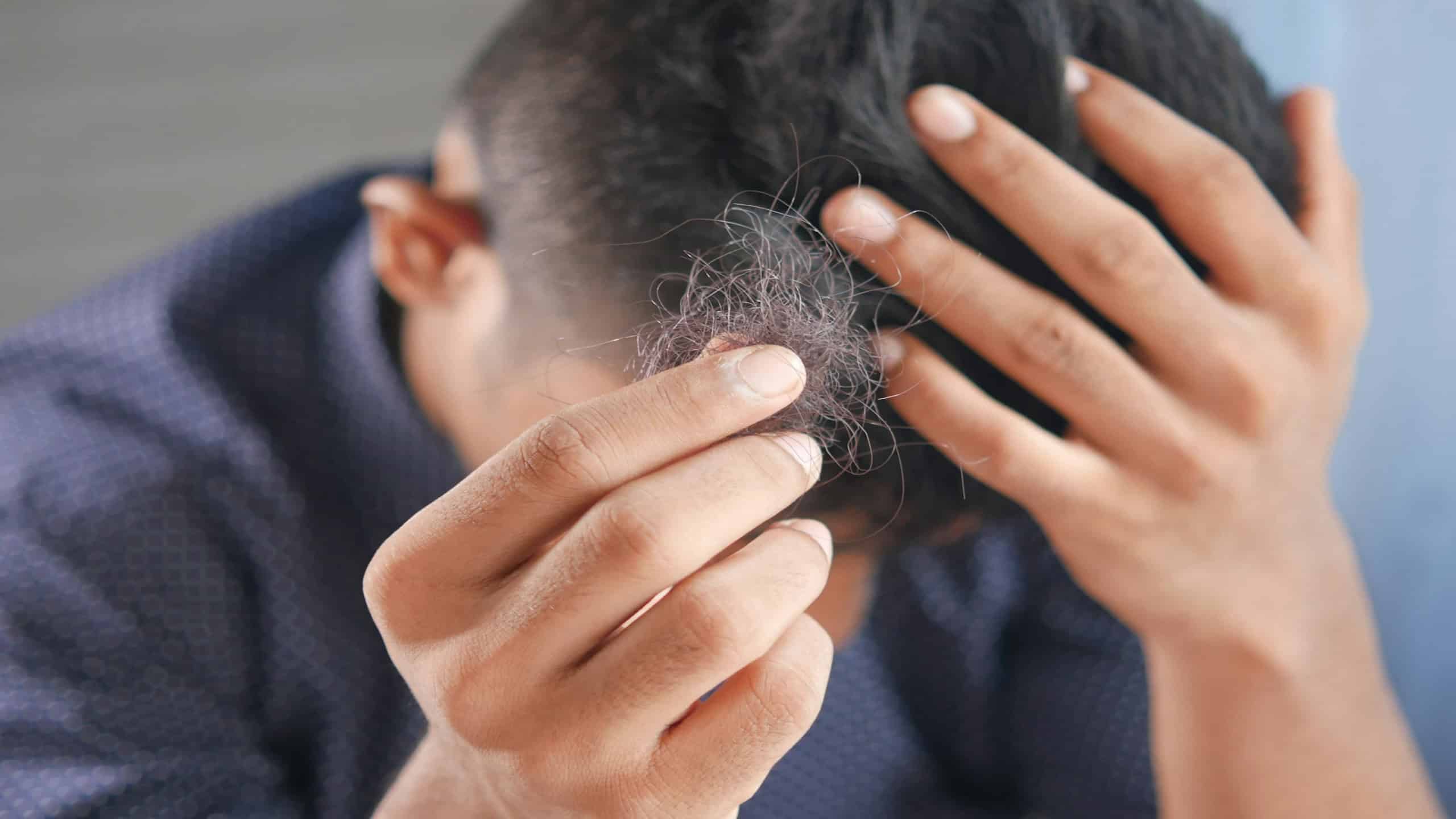 Mounjaro e Ozempic podem causar queda de cabelo? Entenda