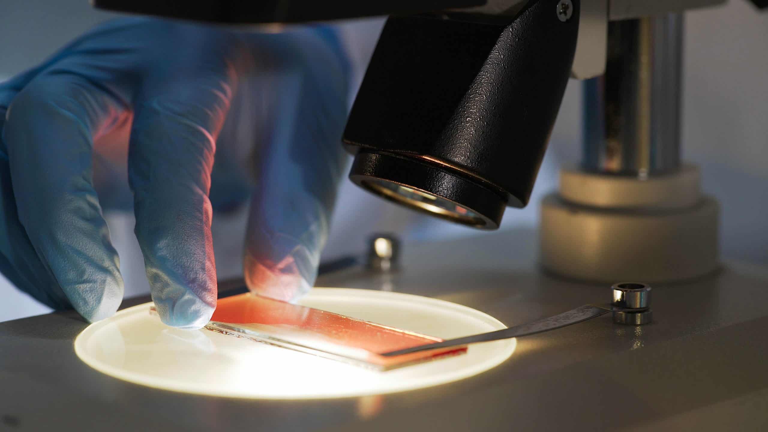 O que é um microscópio? Entenda como funciona esse equipamento
